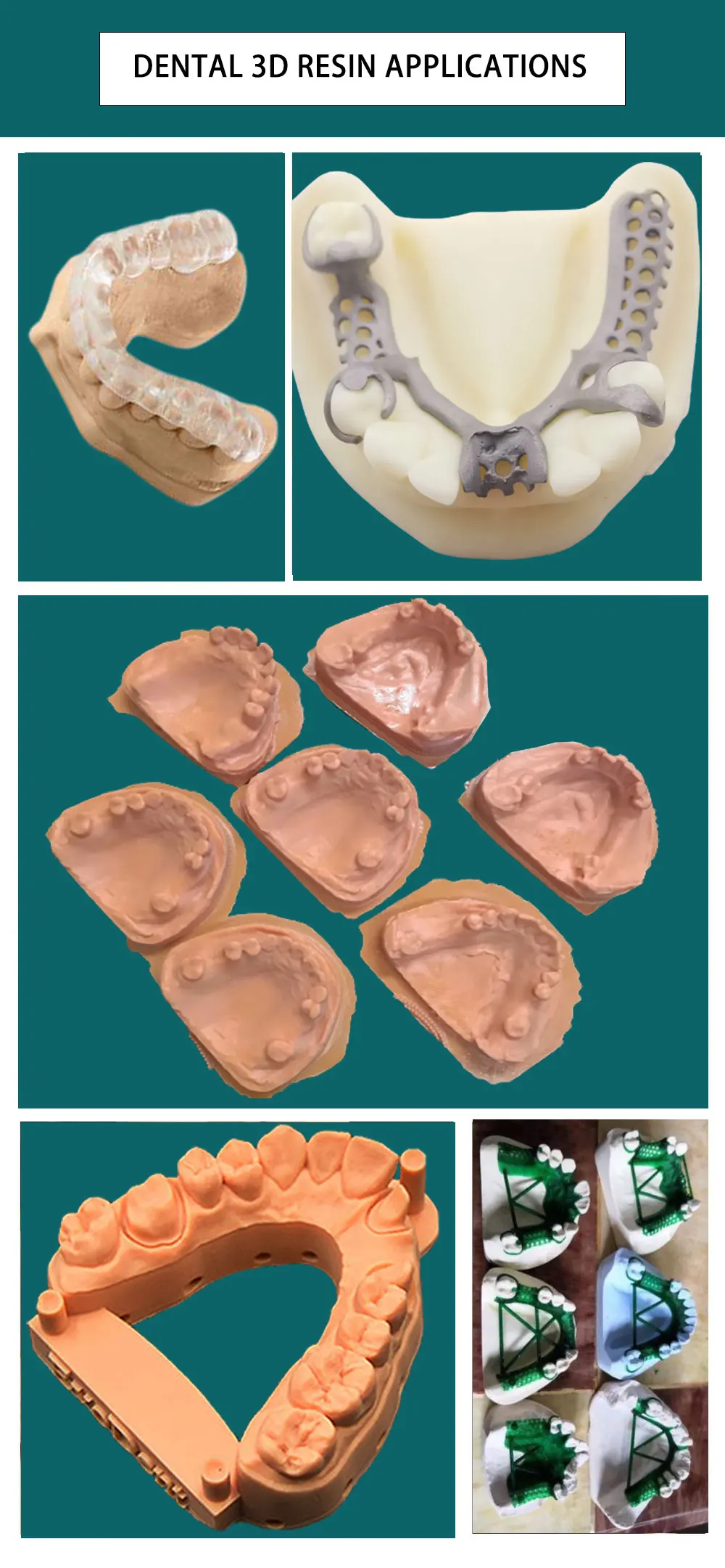 의료 등급 A1/A2 컬러 랩 임시 C&B 500g/3 - 3D Printing For Medical 리뷰 및 가격
